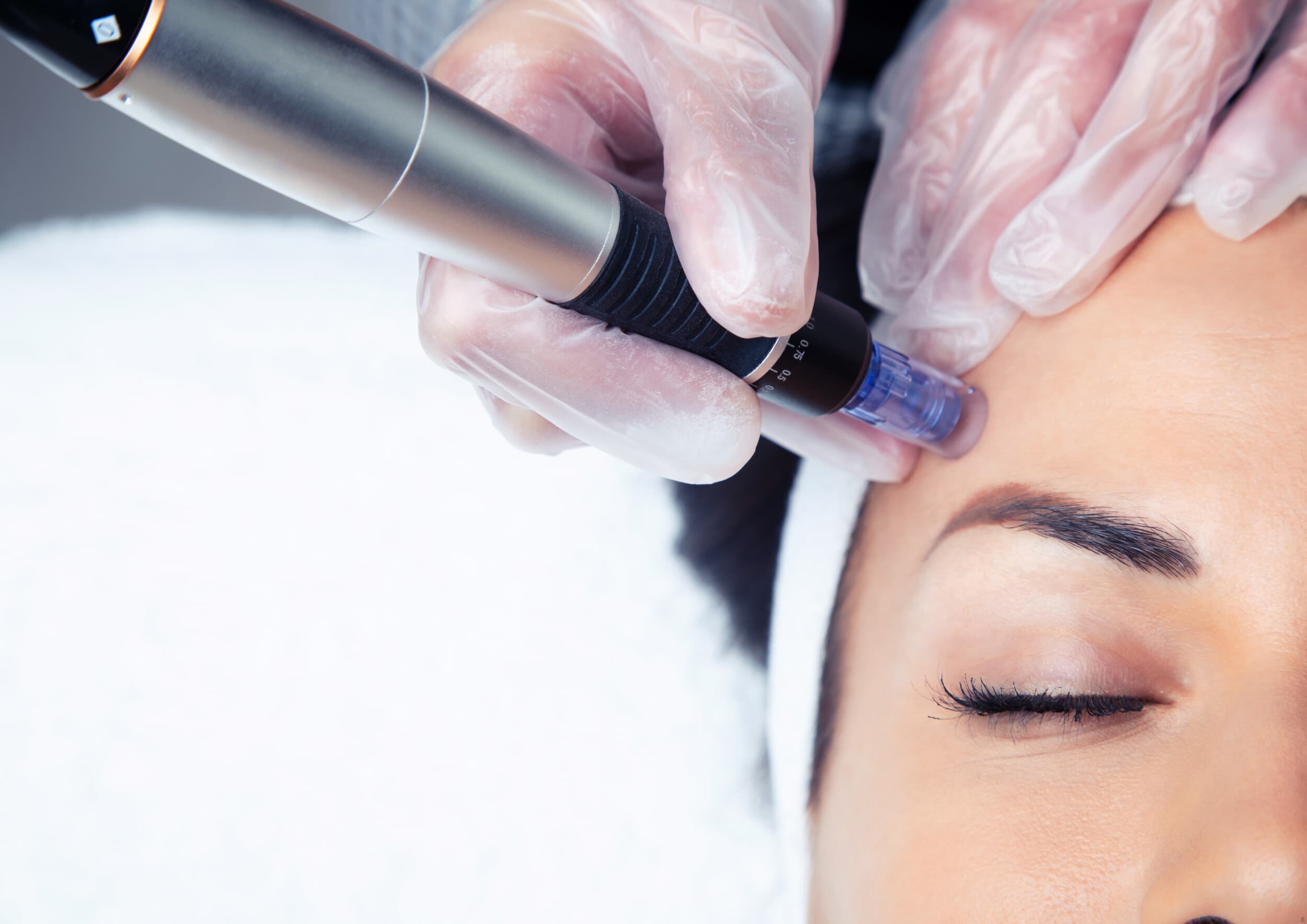Mezoterapia Mikroigłowa "DermaPen Vitamin Shot" | Katowice | Wyjątkowy Prezent