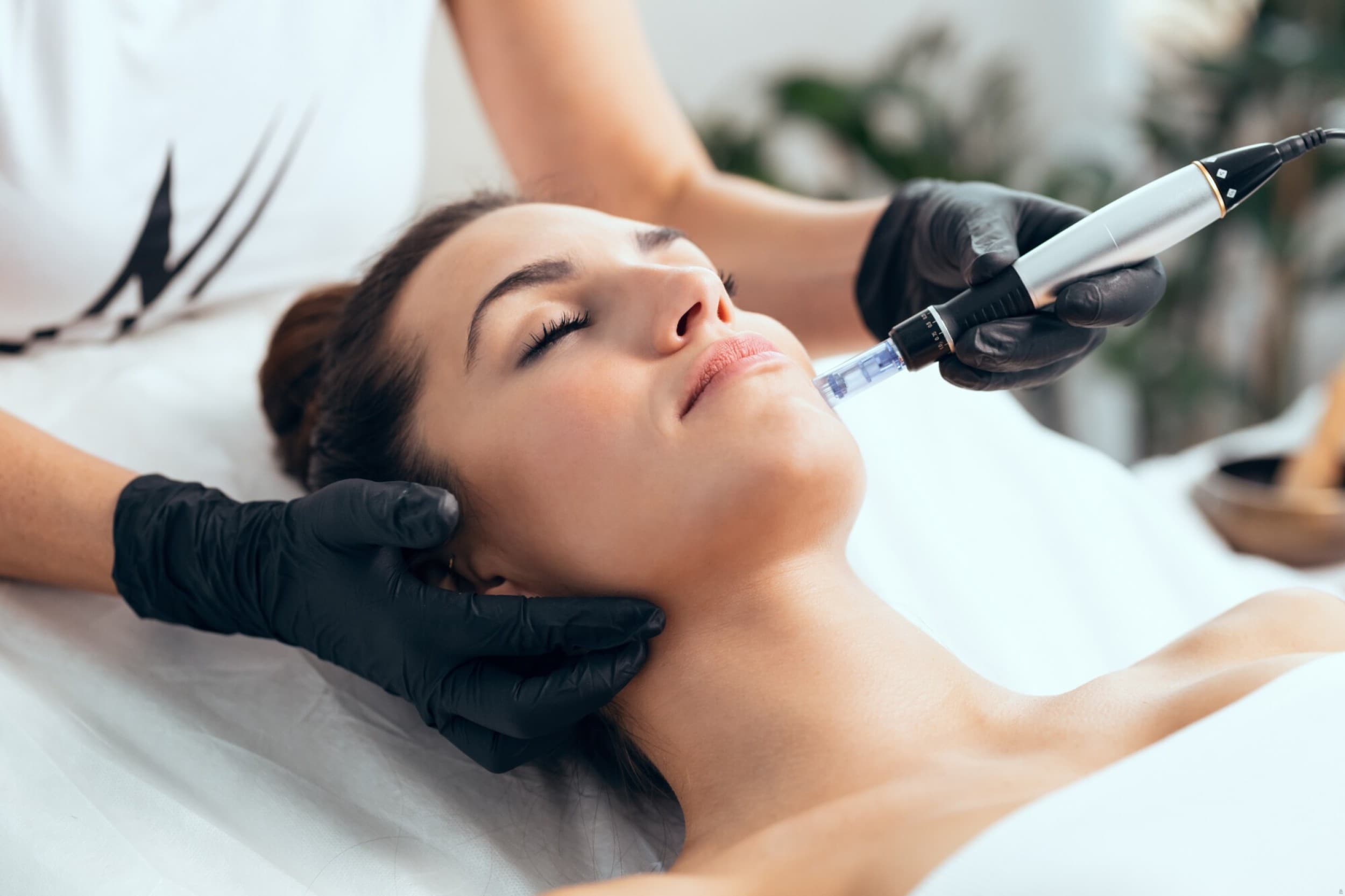 Mezoterapia Mikroigłowa na Twarz, Szyję i Dekolt "Nano Crystal Pen" | Bielsko-Biała | Wyjątkowy Prezent